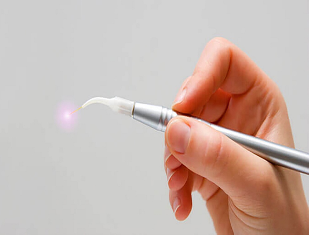 The first introduction of dental lasers at Almana hospital.